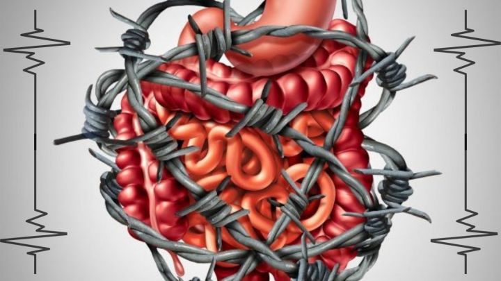 Intestino irritable: ¿Cómo reconocerlo y tratarlo?